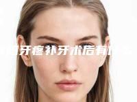 濮阳牙疼补牙术后有什么注意事项