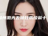 滁州激光去除妊辰纹前十名排名榜名单宣布+滁州市第一人民医院烧伤整形科都被大家熟知