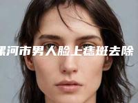 漯河市男人脸上痣斑去除价格需多少钱-价格在3663元起