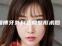 淄博牙外科正畸整形术后护理怎么做,多长时间能恢复