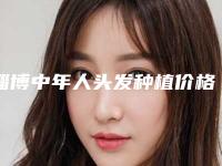 淄博中年人头发种植价格多少钱比较合适