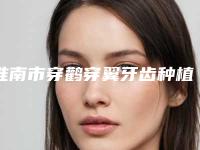 淮南市穿鹳穿翼牙齿种植排行榜十强全面盘查-淮南市穿鹳穿翼牙齿种植口腔医生