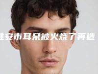 淮安市耳朵被火烧了再造耳朵医院比较正规(淮安丽都医疗美容门诊部机构口碑与实力双重保障)