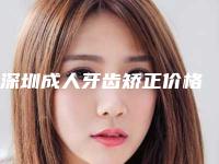 深圳成人牙齿矫正价格