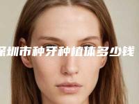 深圳市种牙种植体多少钱-深圳市种牙种植体医院排名榜十强年度推荐