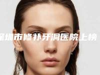 深圳市修补牙洞医院上榜名单前十强榜单大分享(深圳市修补牙洞口腔医院被网友盛赞)