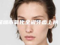 深圳市氧化全瓷牙齿上榜名单前十强正规出圈-深圳市氧化全瓷牙齿口腔医生