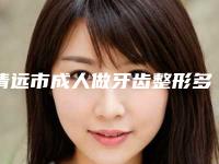 清远市成人做牙齿整形多少钱-清远市成人做牙齿整形医院在榜清单技术比拼,实力一清二楚