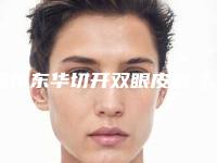 温州东华切开双眼皮图(温州和平整形谁有割过双眼皮)