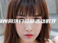 湖州同济门诊部活动假牙塑钢牙后应做哪些护理