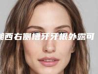 湘西右侧槽牙牙根外露可能发生哪些副作用