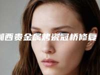 湘西贵金属烤瓷冠桥修复费用介绍