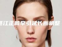 湛江正畸牵引延长断根整形针对什么样的人群