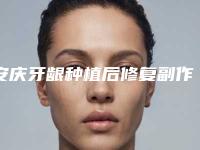 安庆牙龈种植后修复副作用_安庆牙龈种植副是否有副作用