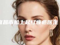 宜昌市脸上起红痤疮医生排行榜前十名权威盘点-涂江晖整形医生实力不可挡