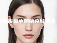 宝鸡市鼻中隔峭突做手术医院上榜名单top10强专业之选（宝鸡市鼻中隔峭突做手术整形医院）