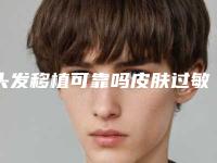 头发移植可靠吗皮肤过敏能做吗头发移植的效果有保证吗
