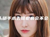 头部手术去除疤痕会不会影响正常呼吸