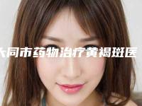 大同市药物治疗黄褐斑医生在榜名单实力真不错-刘海元医生有上榜