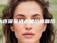 大连保妥适去皱后修复后遗症
