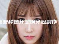 德宏种植牙塑钢牙冠副作用介绍