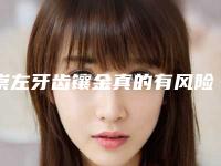 崇左牙齿镶金真的有风险吗
