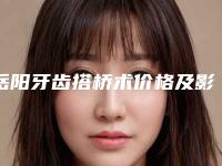 岳阳牙齿搭桥术价格及影响因素