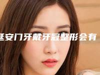 延安门牙戴牙冠整形会有什么害处