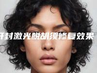 开封激光脱胡须修复效果详细介绍_开封激光脱胡须安不安全效果好不好