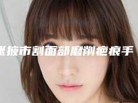 张掖市割面部磨削疤痕手术医院哪里好(张掖蔚蓝十八度医疗美容诊所私立医美可圈可点)