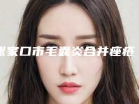 张家口市毛囊炎合并痤疮治疗医院哪家-张家口市第四医院医疗美容科性价比超高哦