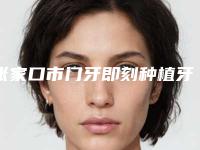 张家口市门牙即刻种植牙医生排名前十名公测-张家口市曹岩口腔医生