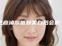 巴彦淖尔嫩肤美白后会影响排汗吗