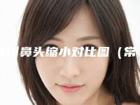 常州鼻头缩小对比图(常德鼻头缩小哪家好爱思特美丽热线)