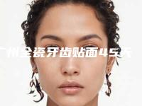 广州全瓷牙齿贴面45天效果对比