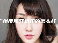 广州反颌牙矫正的怎么样能管多久