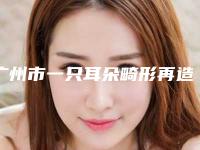 广州市一只耳朵畸形再造整形美容外科价格表(价目)详情呈现(2025年3月均价为:56637元)