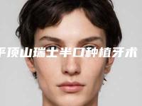 平顶山瑞士半口种植牙术的报价