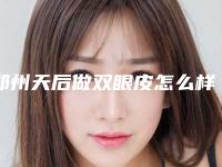 郑州天后做双眼皮怎么样[郑州天后整形医院]