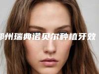 鄂州瑞典诺贝尔种植牙效果到底怎么样呢