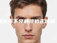 通化市下牙拥挤矫正价格表完整全新上线-通化市下牙拥挤矫正价格