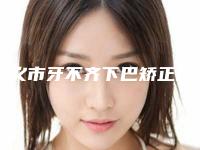 遵义市牙不齐下巴矫正医生上榜清单top10值得过去-遵义市刘福荣口腔医生