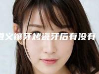 遵义镶牙烤瓷牙后有没有什么风险