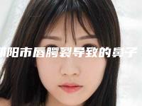 邵阳市唇腭裂导致的鼻子塌陷修复费用表明细官方曝光(近6个月均价为:39880元)