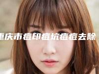 重庆市痘印痘坑痘痘去除医院在榜清单前十名靠谱名单一览-重庆市痘印痘坑痘痘去除整形医院