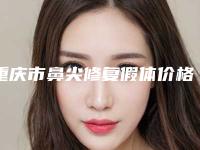 重庆市鼻尖修复假体价格(收费标准)一览新出(鼻尖修复假体均价为:12220元)