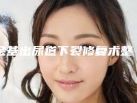 金基出尿道下裂修复术整形手术比较安全