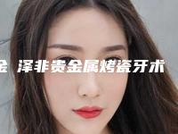金涥泽非贵金属烤瓷牙术的作用持续多久