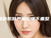 面部肌肤严重松弛下垂整形能够持续多长时间