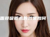 面颊吸脂术的效果如何